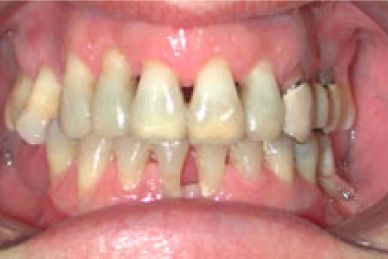 Clínica De Ortodoncia Doctores Diaz De Villafranca dientes